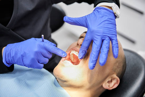 Best Emergency Wisdom Tooth Extraction in Pulaski, VA